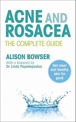 Book Acne and Rosacea: The Complete Guide free
