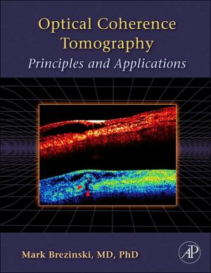 Book Optical Coherence Tomography: Principles and Applications free