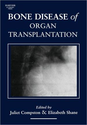 Book Bone Disease of Organ Transplantation free Book Bone Disease of Organ Transplantation free