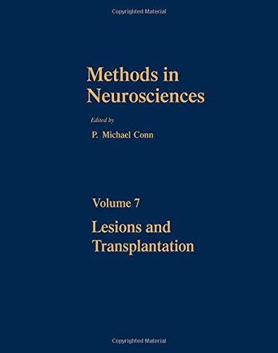 Book Methods in Neurosciences: Lesions and Transplantation free