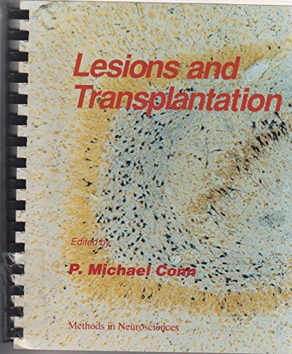 Book Lesions And Transplantation, Volume 7: Volume 7: Lesions And Transplantation (methods In Neurosciences) free