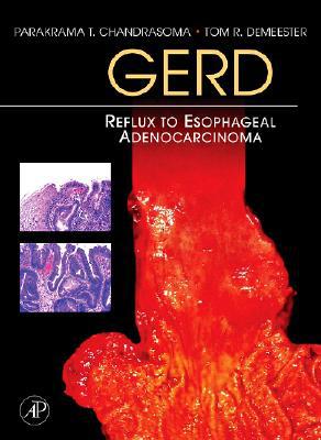 Book GERD: Reflux to Esophageal Adenocarcinoma free