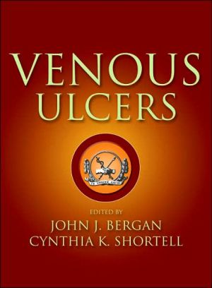 Book Venous Ulcers free
