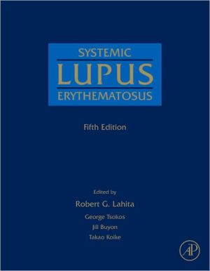 Book Systemic Lupus Erythematosus free