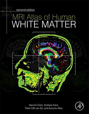Book MRI Atlas of Human White Matter free