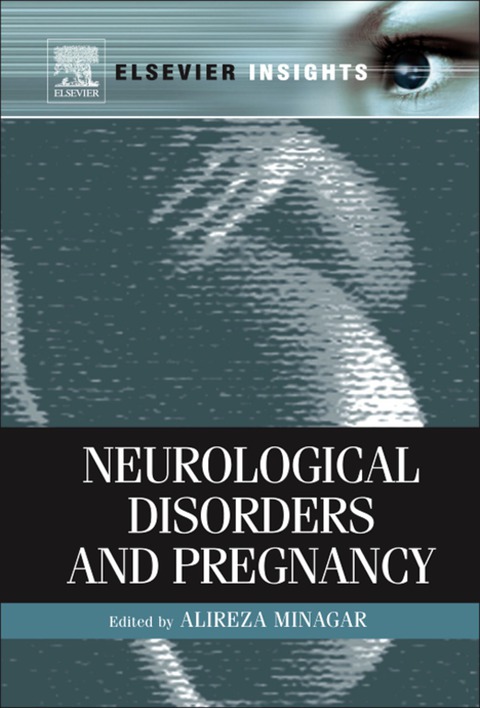Book Neurological Disorders and Pregnancy free