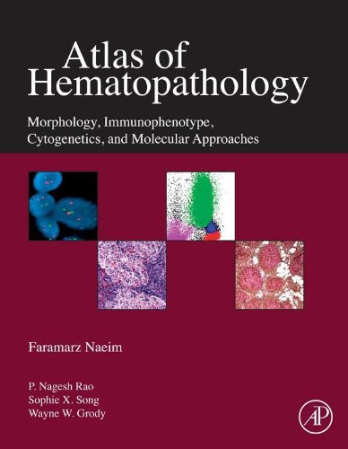 Book Atlas of Hematopathology: Morphology, Immunophenotype, Cytogenetics, and Molecular Approaches free