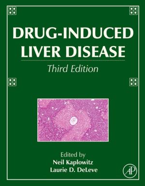 Book Drug-Induced Liver Disease free