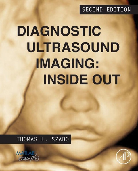 Book Diagnostic Ultrasound Imaging: Inside Out (Biomedical Engineering) free