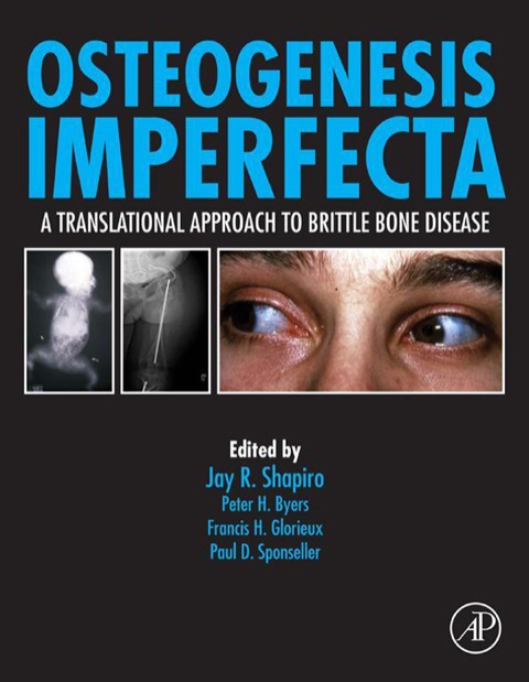 Book Osteogenesis Imperfecta: A Translational Approach to Brittle Bone Disease free