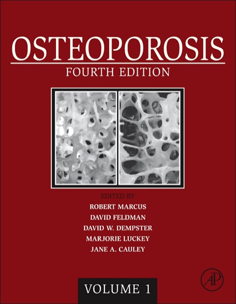 Book Osteoporosis free