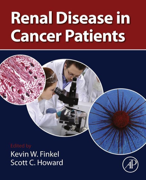 Book Renal Disease in Cancer Patients free