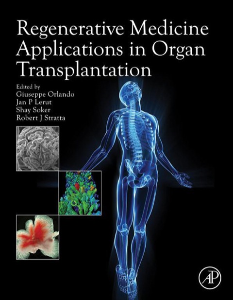 Book Regenerative Medicine Applications in Organ Transplantation free