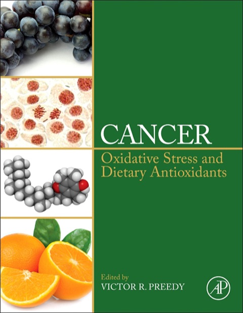 Book Cancer: Oxidative Stress and Dietary Antioxidants free