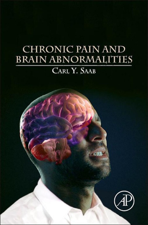 Book Chronic Pain and Brain Abnormalities free