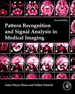 Book Pattern Recognition and Signal Analysis in Medical Imaging free
