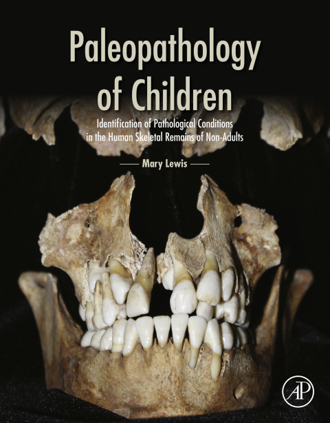 Book Paleopathology of Children: Identification of Pathological Conditions in the Human Skeletal Remains of Non-Adults free