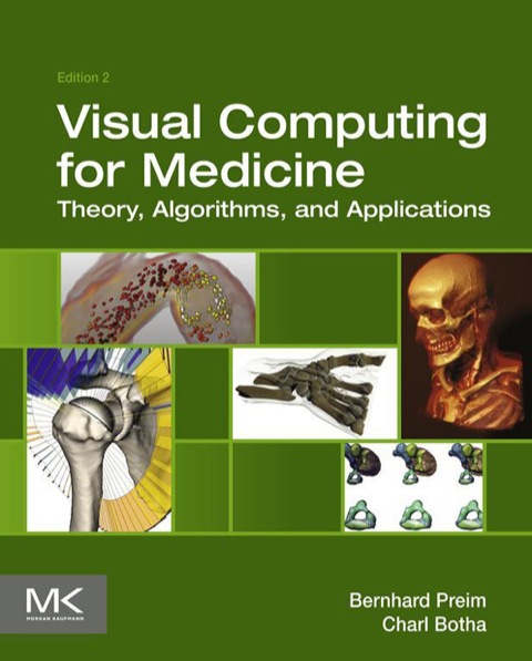 Book Visual Computing for Medicine: Theory, Algorithms, and Applications (The Morgan Kaufmann Series in Computer Graphics) free