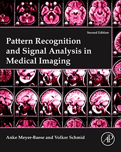 Book Pattern Recognition and Signal Analysis in Medical Imaging free