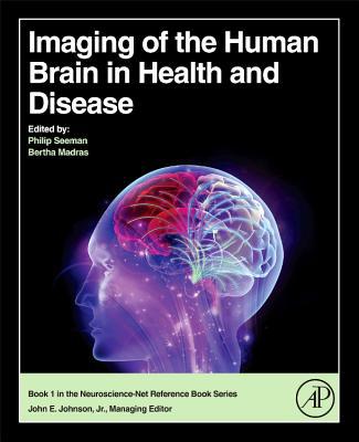 Book Imaging of the Human Brain in Health and Disease free