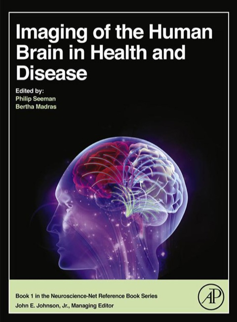 Book Imaging of the Human Brain in Health and Disease free