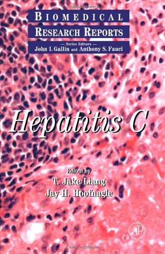 Book Hepatitis C (Biomedical Research Reports - vol 2) (Volume 2) free