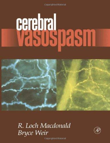 Book Cerebral Vasospasm free