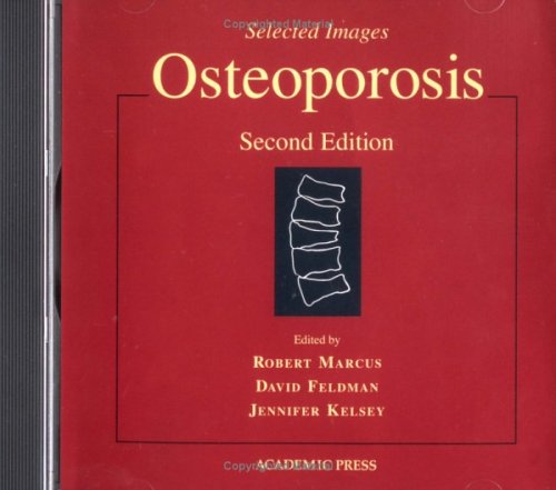 Book Osteoporosis, CD-ROM free