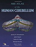 Book MRI Atlas of the Human Cerebellum free