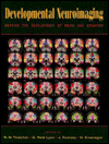 Book Developmental Neuroimaging: Mapping the Development of Brain and Behavior free
