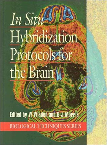 Book In Situ Hybridization for the Brain (Series: Biological Techniques) free