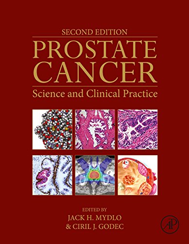 Book Prostate Cancer: Science and Clinical Practice free