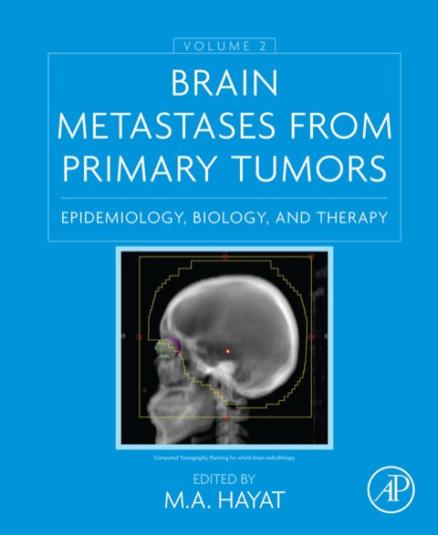 Book Brain Metastases from Primary Tumors, Volume 2: Epidemiology, Biology, and Therapy free