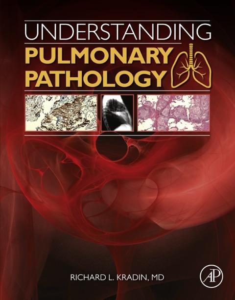 Book Understanding Pulmonary Pathology free