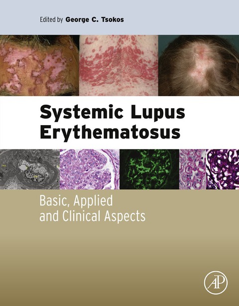 Book Systemic Lupus Erythematosus: Basic, Applied and Clinical Aspects free