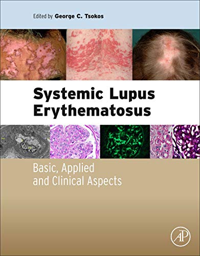 Book Systemic Lupus Erythematosus: Basic, Applied and Clinical Aspects free