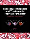 Book Endoscopic Diagnosis and Treatment in Prostate Pathology: Handbook of Endourology free