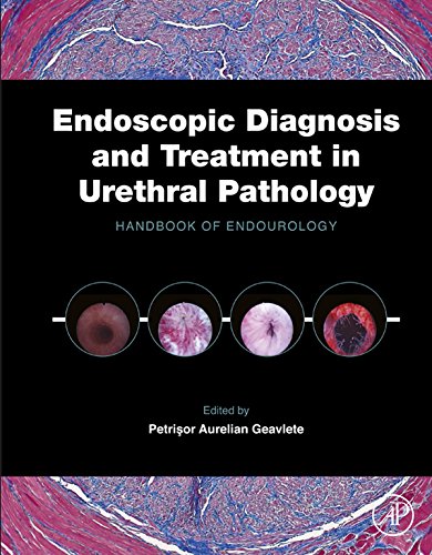 Book Endoscopic Diagnosis and Treatment in Urethral Pathology: Handbook of Endourology free