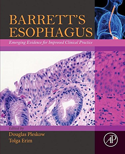 Book Barrett’s Esophagus: Emerging Evidence for Improved Clinical Practice free