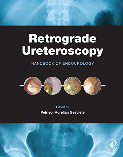 Book Retrograde Ureteroscopy: Handbook of Endourology free
