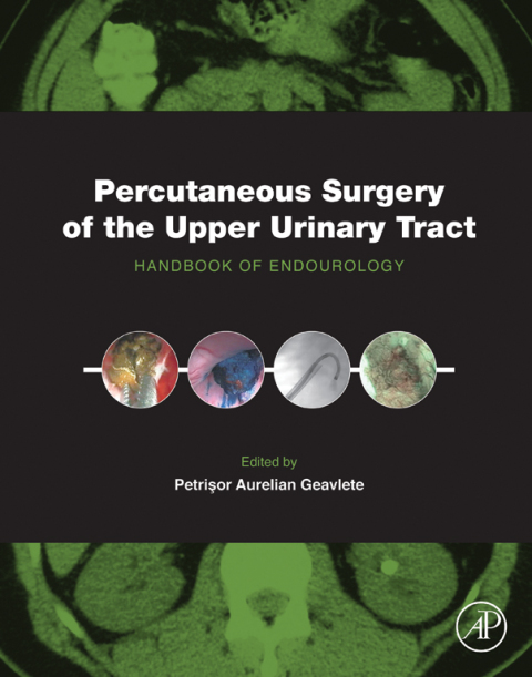 Book Percutaneous Surgery of the Upper Urinary Tract free