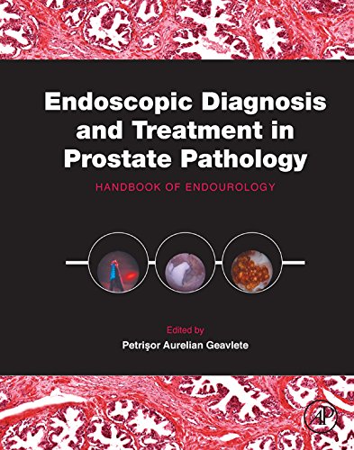 Book Endoscopic Diagnosis and Treatment in Prostate Pathology: Handbook of Endourology free
