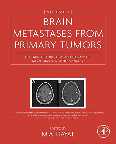 Book Brain Metastases from Primary Tumors, Volume 3: Epidemiology, Biology, and Therapy of Melanoma and Other Cancers free