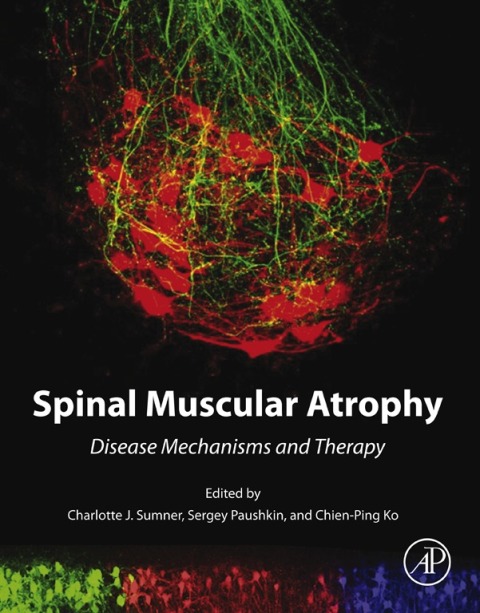Book Spinal Muscular Atrophy free