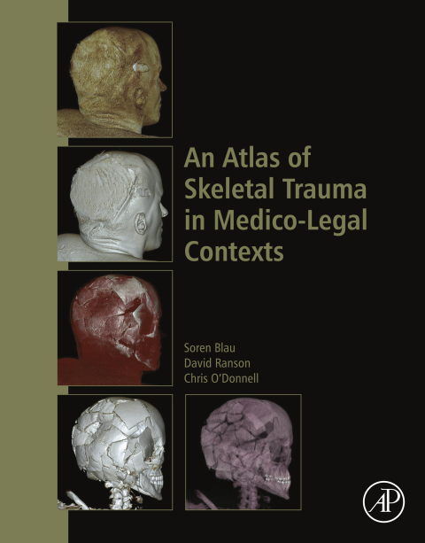 Book An Atlas of Skeletal Trauma in Medico-Legal Contexts free