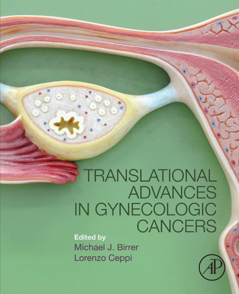 Book Translational Advances in Gynecologic Cancers free
