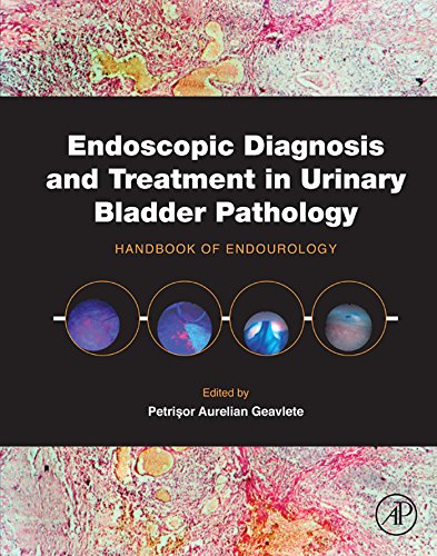 Book Endoscopic Diagnosis and Treatment in Urinary Bladder Pathology: Handbook of Endourology free