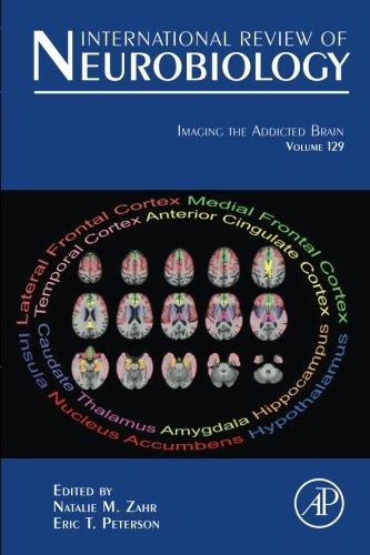 Book Imaging the Addicted Brain (Volume 129) (International Review of Neurobiology, Volume 129) free