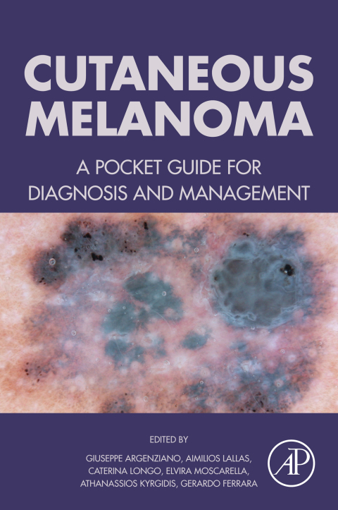 Book Cutaneous Melanoma: A Pocket Guide for Diagnosis and Management free