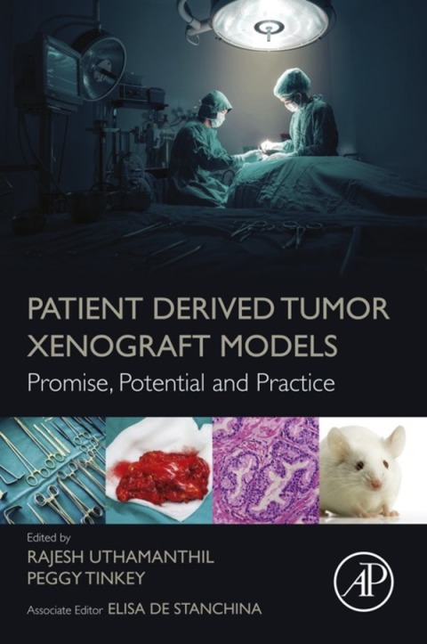 Book Patient Derived Tumor Xenograft Models free